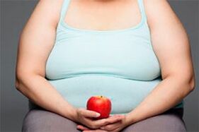 Lai izārstētu varikozas vēnas, jums ir jāatbrīvojas no liekā svara